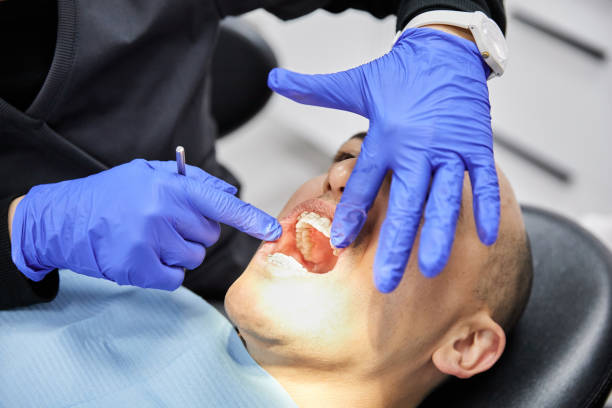 Best Emergency Gum Treatment in Eureka, MO