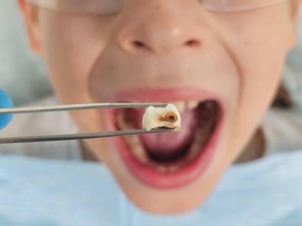 Best Same-Day Emergency Dental Services in Eureka, MO
